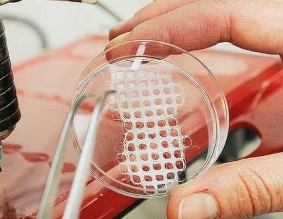 Medical Implant Materials